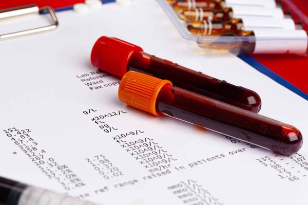 Comment savoir si c'est la batterie ou le chargeur du PC ?